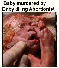 Baby Aborted