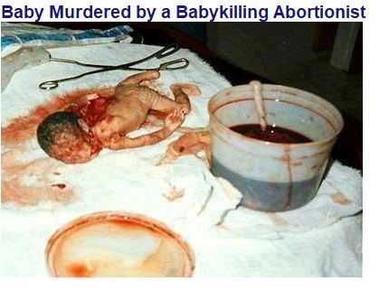 Aborted Baby